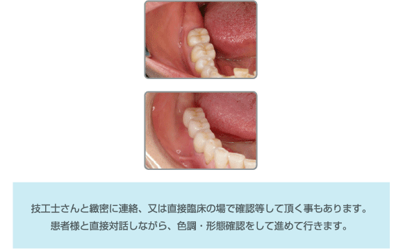 形態・色調・機能回復